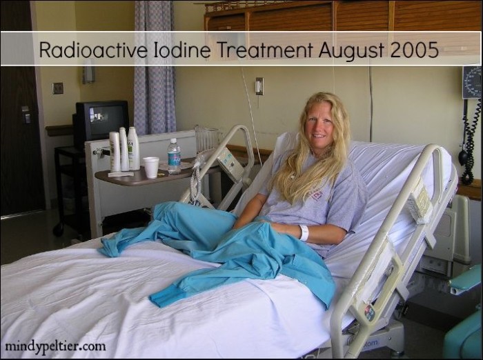 Radioactive Iodine Treatment August 2005 @MindyJPeltier #thyroidcancer